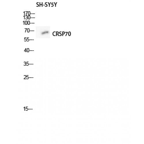 MED26 / CRSP7 Antibody (1-80 aa, N-terminal)