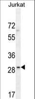 Polyclonal Rabbit anti-Human LRRC25 Antibody (aa242-270, WB)