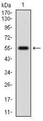 Monoclonal Mouse anti-Human NFE2L2 / NRF2 Antibody (clone 1A6G6, aa356-589, IHC, WB)
