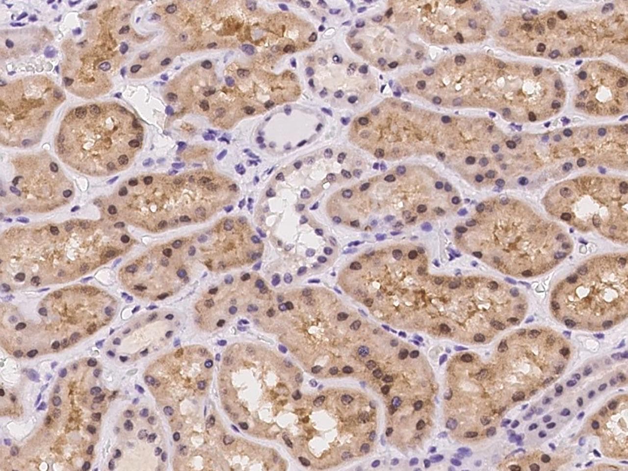 GALK2 Antibody