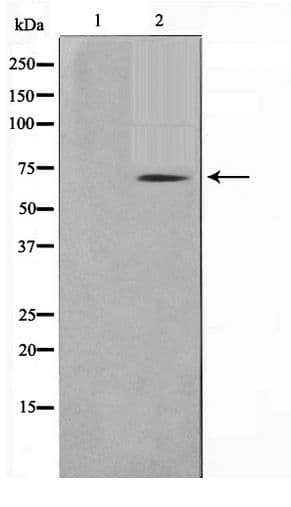 TGFBR2 Antibody