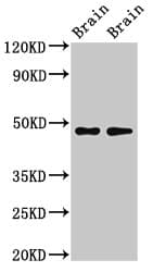 CRHR2 / CRF2 Receptor Antibody