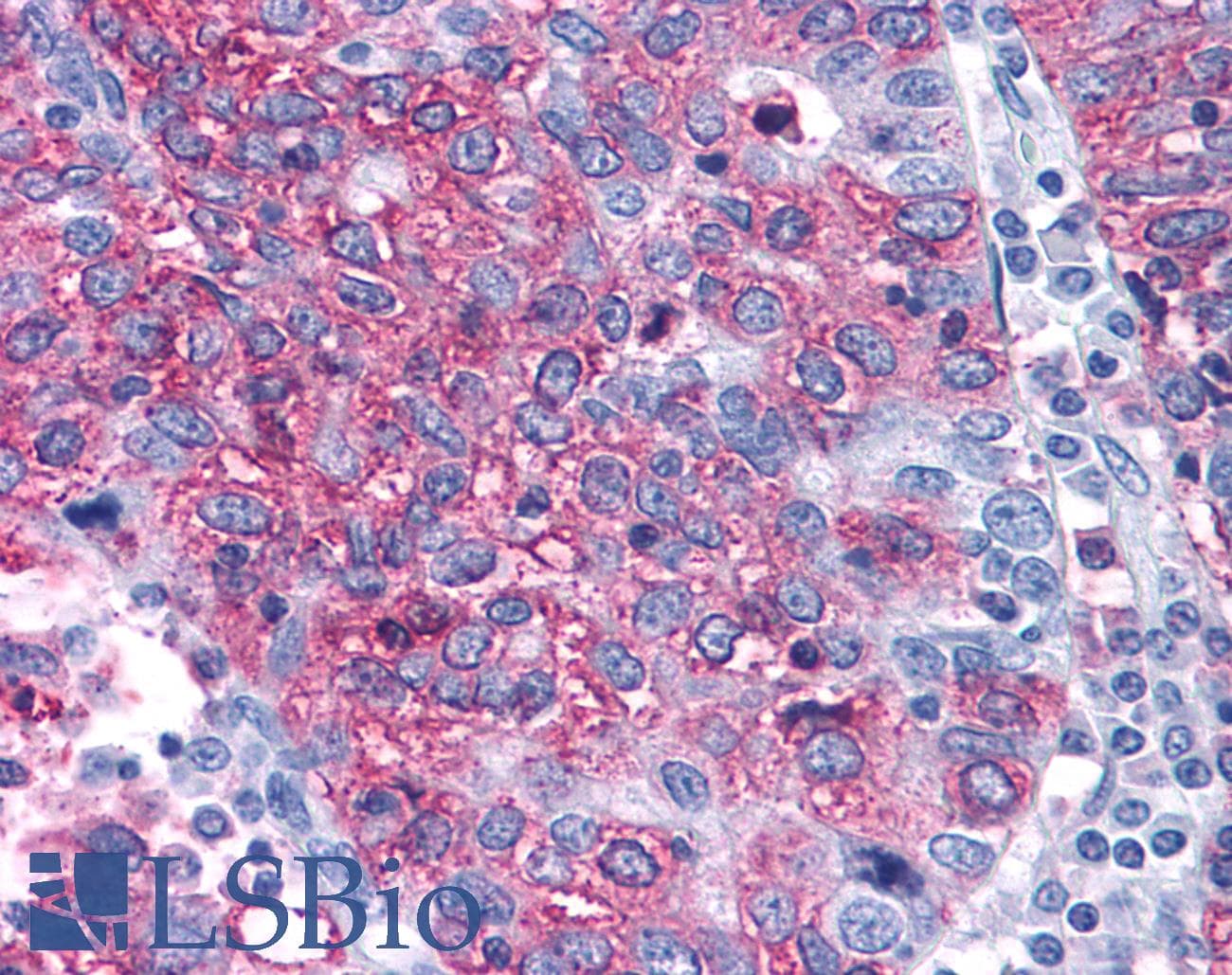 PathPlus™ Polyclonal Rabbit anti-Human MAPK3 / ERK1 Antibody (Internal, IHC)