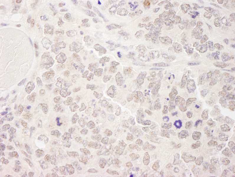 SKIV2L2 Antibody (aa100-150)