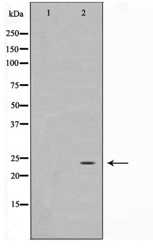 IPP2 / PPP1R2 Antibody