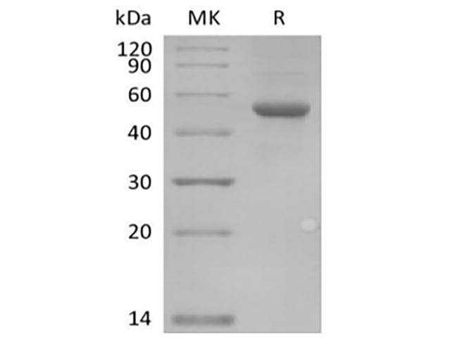 Human ILDR2 Protein (Recombinant Fc, C-terminus)