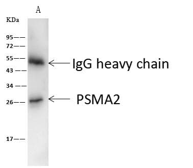 Polyclonal Rabbit anti-Human PSMA2 Antibody (IHC, WB)