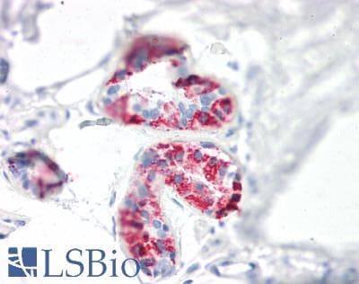 Polyclonal Rabbit anti-Human FHL2 Antibody (IHC, WB)