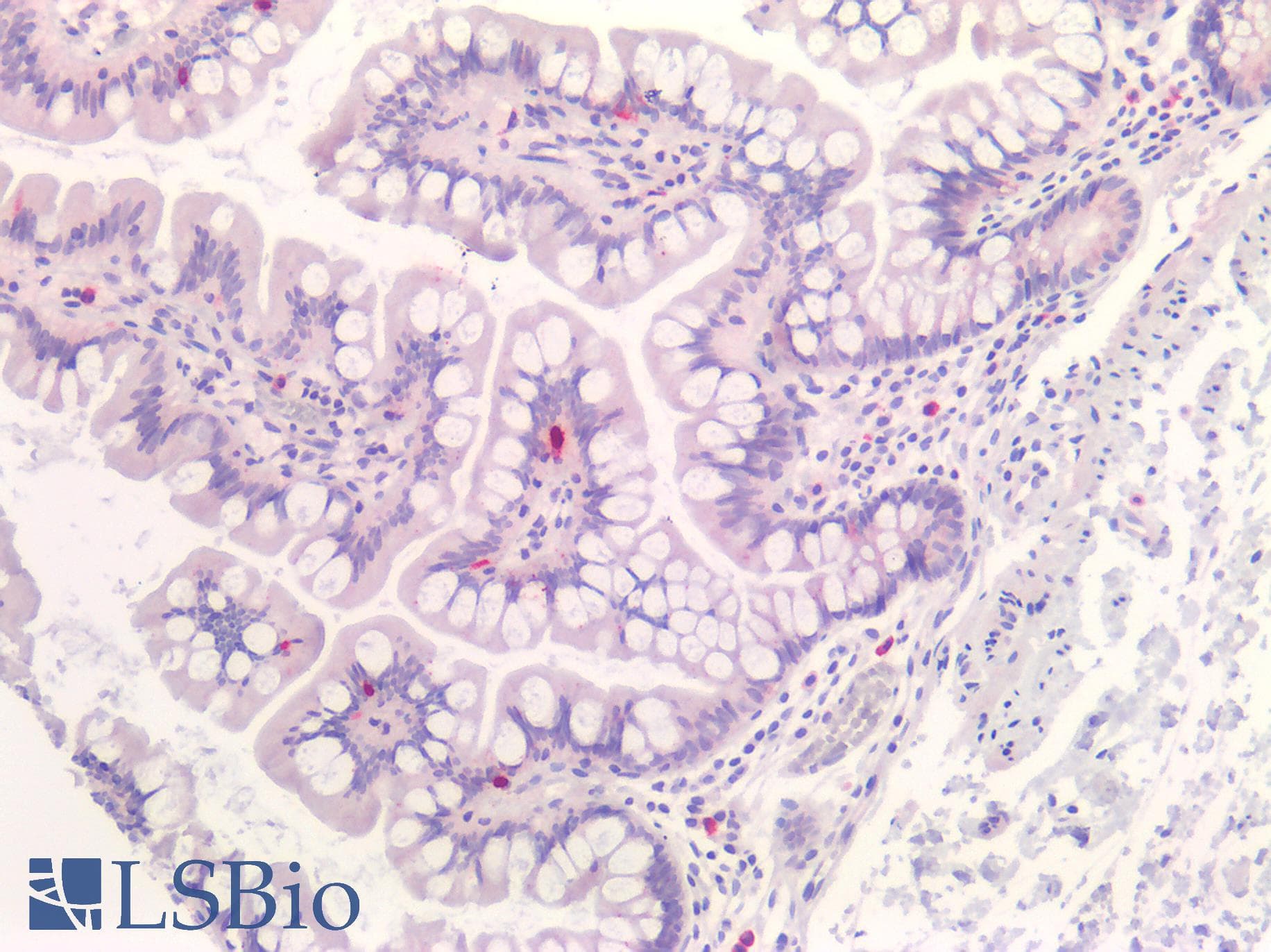 NTS / NT / Neurotensin Antibody (Preservative Free)