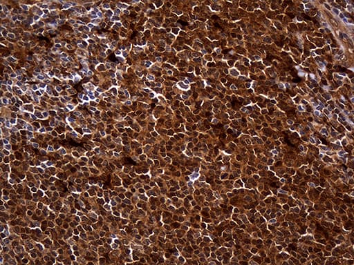 HHLA3 Antibody (clone OTI10B4)