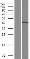 SLC35A2 / UGT Protein (Over-Expression Lysate Myc-DDK (Flag))