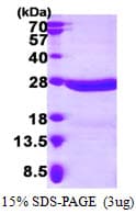 Human CRYBA4 Protein (Recombinant His)
