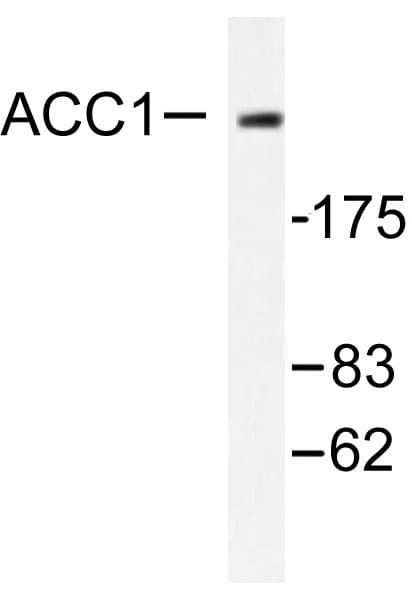 Polyclonal Rabbit anti-Human Acetyl-CoA Carboxylase / ACC Antibody (His74, IHC, WB)