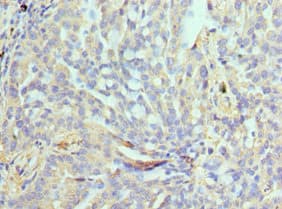 NPR2L / TUSC4 Antibody (aa1-220)