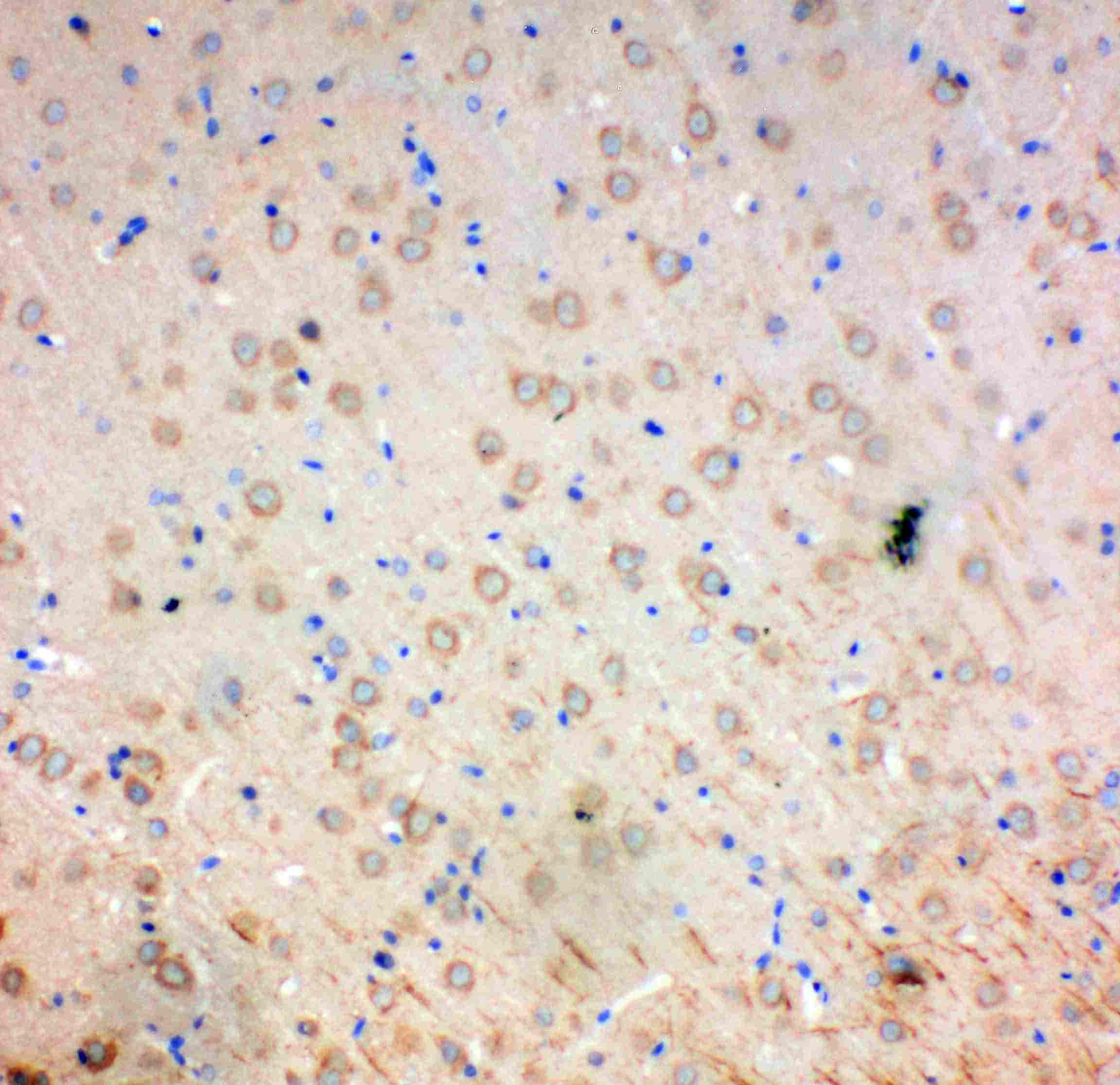 Polyclonal Rabbit anti-Human SOD2 / Mn SOD Antibody (aa45-62, IHC, WB)