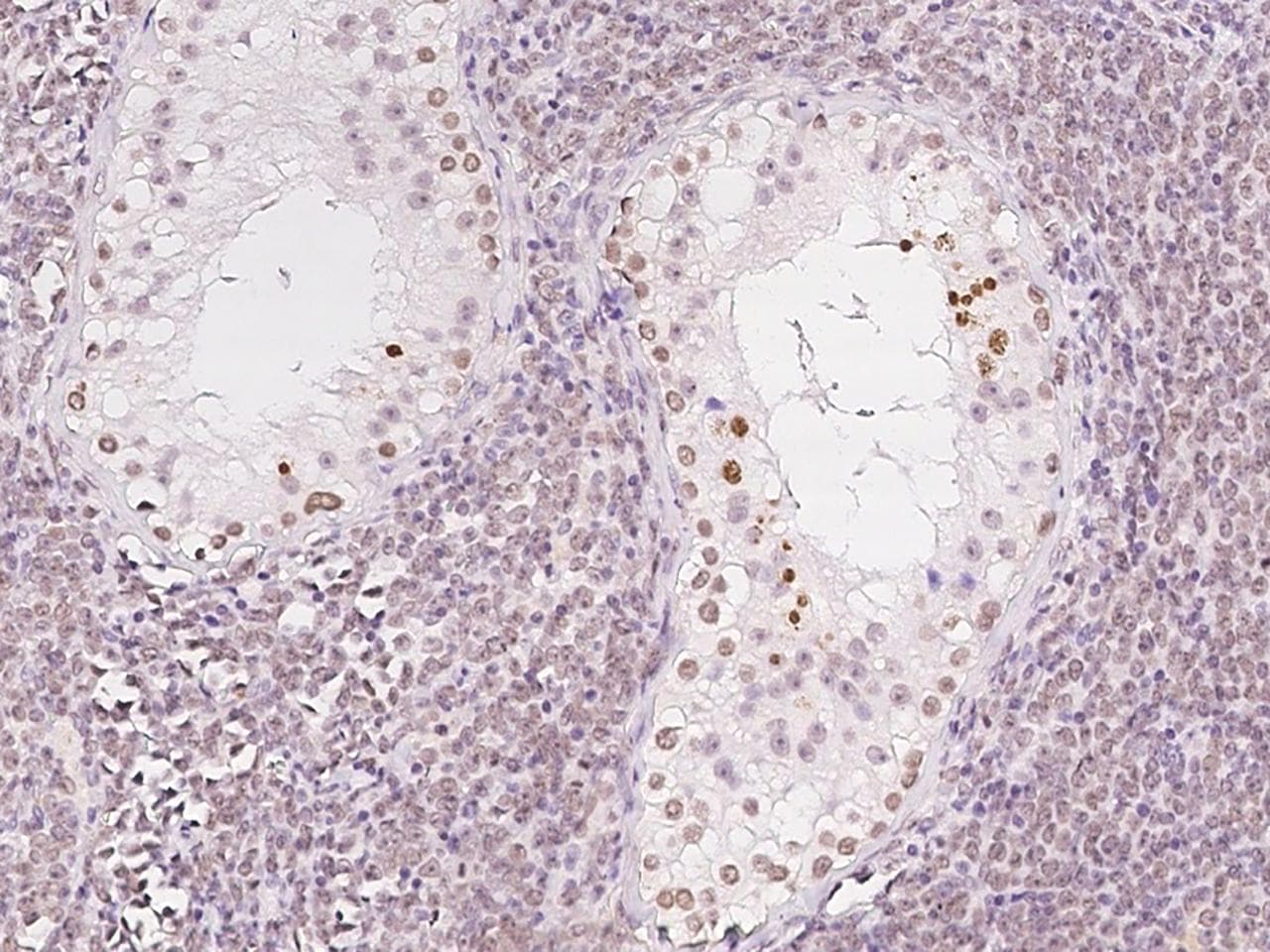 ORC3L / ORC3 Antibody