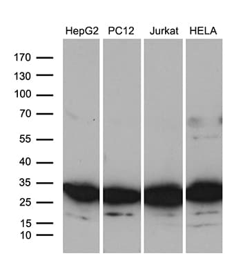 Monoclonal Mouse anti-Human RPL10A Antibody (clone OTI2G9, IHC, WB)
