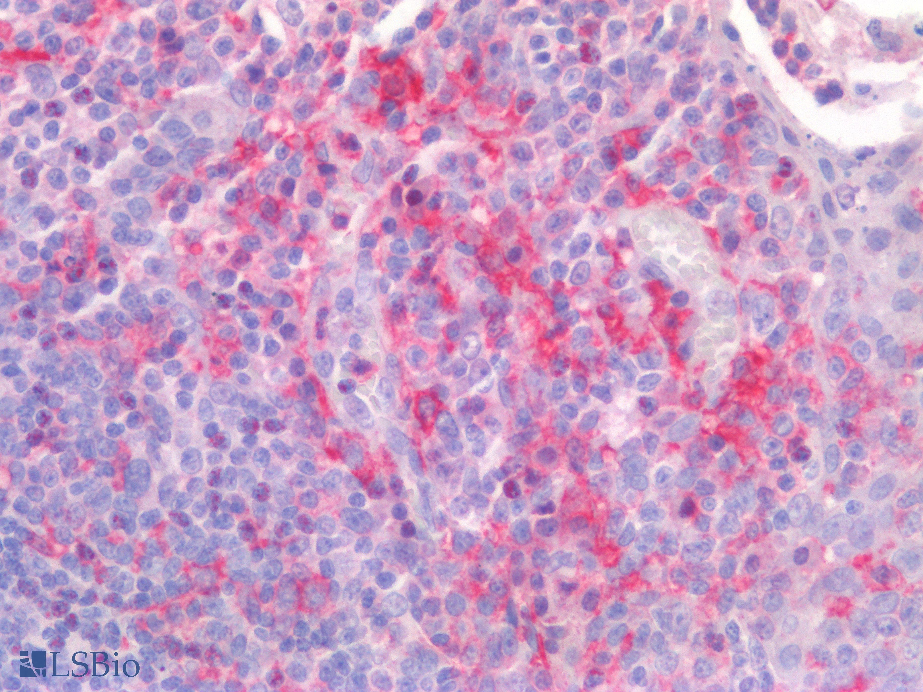 PathPlus™ CD300A Antibody