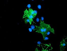 LIMK1 / LIMK Antibody (clone OTI 7C3)