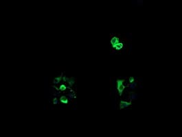 RTKN / Rhotekin Antibody (clone OTI1A4)