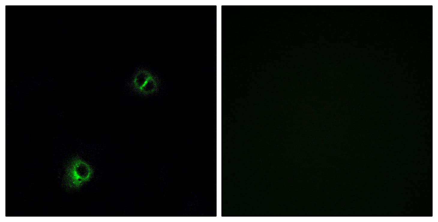 IHC-plus™ Polyclonal Rabbit anti-Human FZD9 / Frizzled 9 Antibody (aa542-591, IHC, IF, WB)
