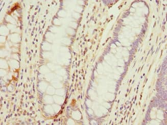 TMED10 / TMP21 Antibody