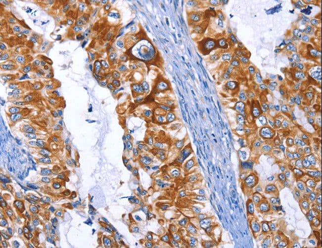 ARRB1 / Beta Arrestin 1 Antibody