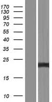 TNFAIP8 / SCC-S2 Protein (Over-Expression Lysate Myc-DDK (Flag))