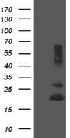REEP5 Antibody (clone OTI4D2)