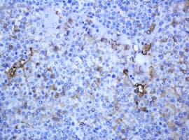 Monoclonal Mouse anti-Human TP / Thymidine Phosphorylase Antibody (clone OTI1H10, IHC, WB)