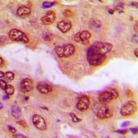 Polyclonal Rabbit anti-Human RPS6KB1 / P70S6K / S6K Antibody (Internal, IHC, IF, WB)