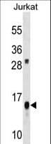 ATP5D Antibody (aa128-157)
