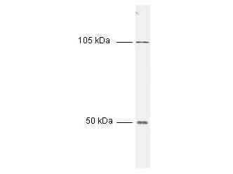 IHC-plus™ Polyclonal Rabbit anti-Human NFKB1 / NF-Kappa-B Antibody (N-Terminus, IHC, WB)