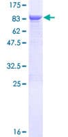 Human TCBE / KCS / HRD Protein (Recombinant GST)