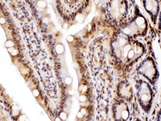 LDHA / LDH1 Antibody