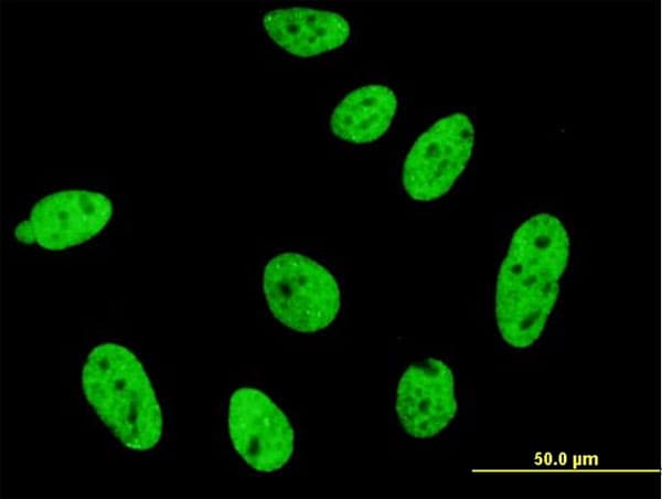 IHC-plus™ CDKL1 Antibody (clone 1F12)