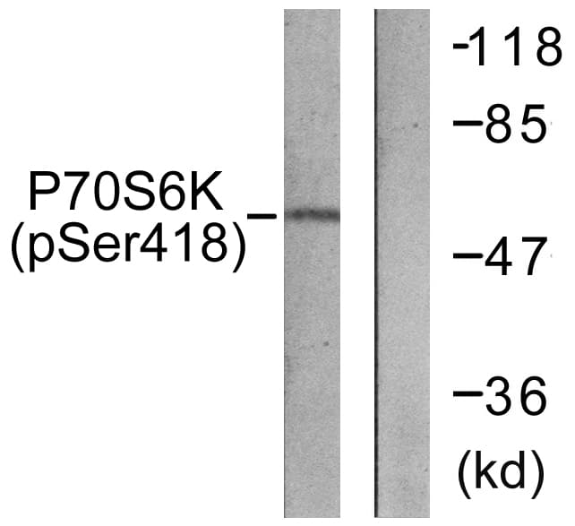 RPS6KB1 / P70S6K / S6K Antibody (phospho-Ser418)