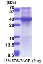 Human Sprouty 4 / SPRY4 Protein (Recombinant His)