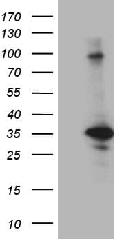 Monoclonal Mouse anti-Human CINP Antibody (clone OTI8E4, WB)