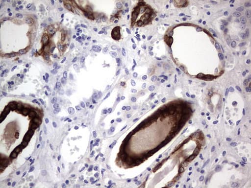 KRT19 / CK19 / Cytokeratin 19 Antibody (aa240-390, clone OTI1A8)