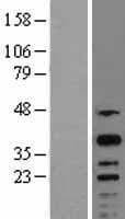 CREM / ICER Protein (Over-Expression Lysate Myc-DDK (Flag))
