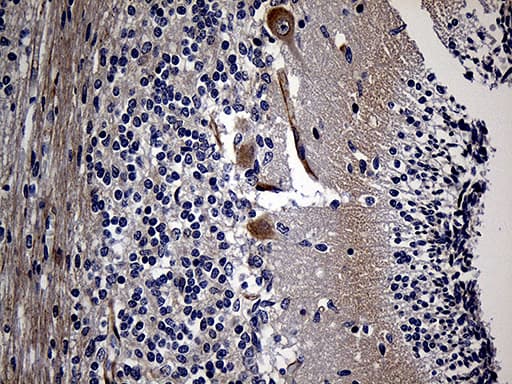 Gravin / AKAP12 Antibody (aa266-557, clone OTI1B6, Carrier-free)