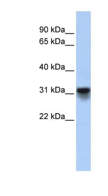 Polyclonal Rabbit anti-Human KDELR3 Antibody (aa71-120, WB)