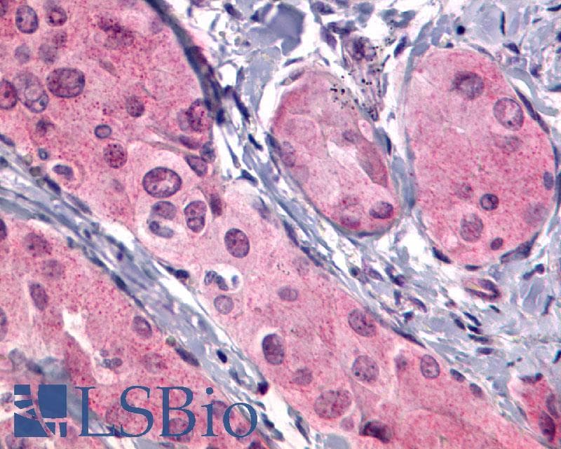 PathPlus™ Polyclonal Rabbit anti-Human TSH Receptor / TSHR Antibody (C-Terminus, IHC)