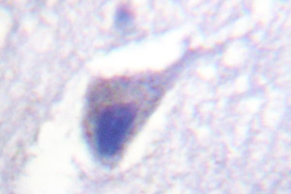 Polyclonal Rabbit anti-Human DNM1 / Dynamin Antibody (Val768, IHC, WB)