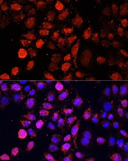 EIF4EBP1 / 4EBP1 Antibody