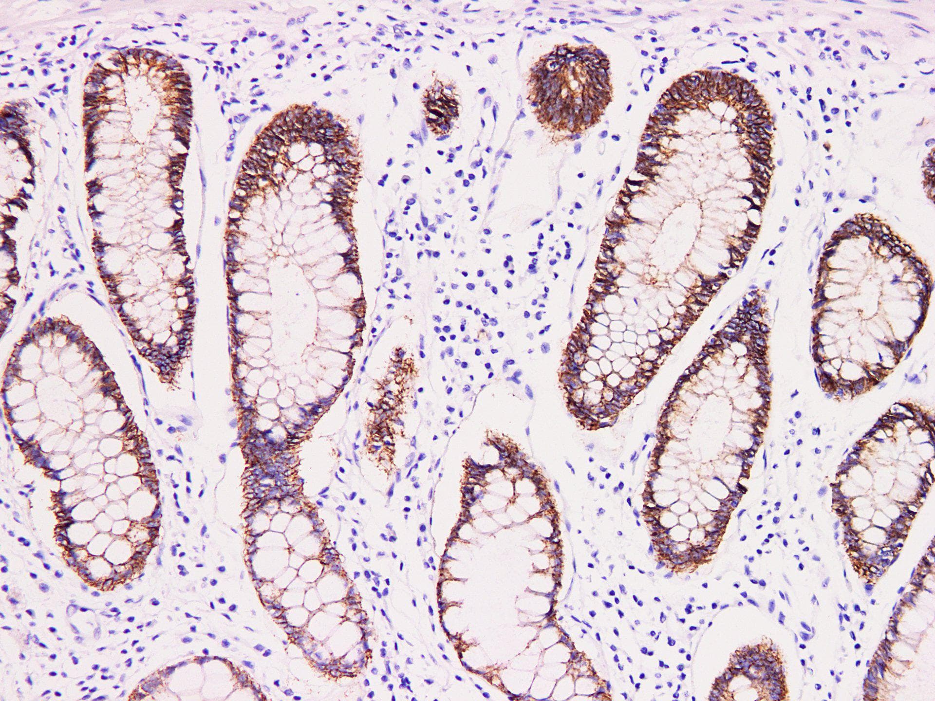 CLDN3 / Claudin 3 Antibody