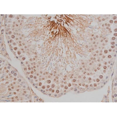 SP1 Antibody (phospho-Thr453)
