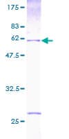 Human HUS1 Protein (Recombinant GST)