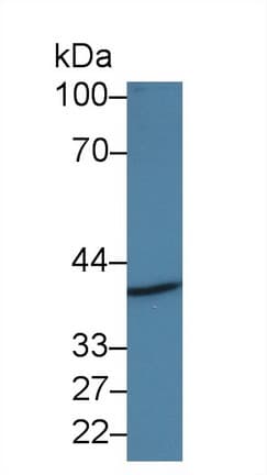 ADAP1 / CENTA1 Antibody (aa45-356)